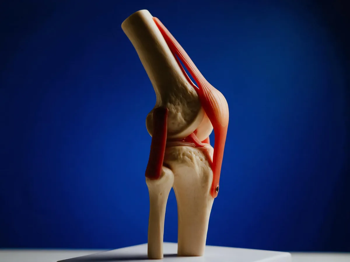 Osteotomia do Joelho — Dr. Guilherme Alvim