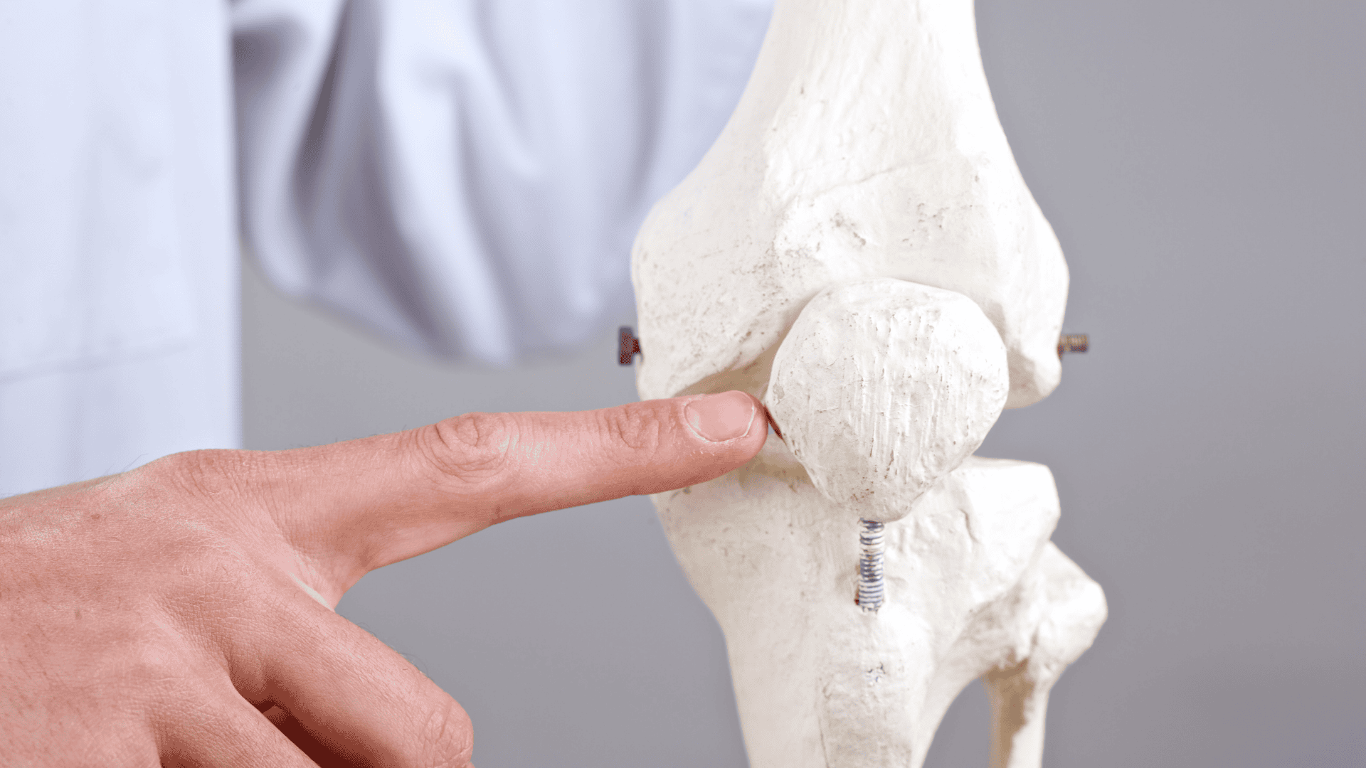 Instabilidade Patelar | Dr. Guilherme Alvim | Ortopedista